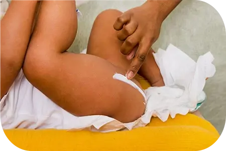 Les rougeurs du siège, des troubles cutanés très fréquents